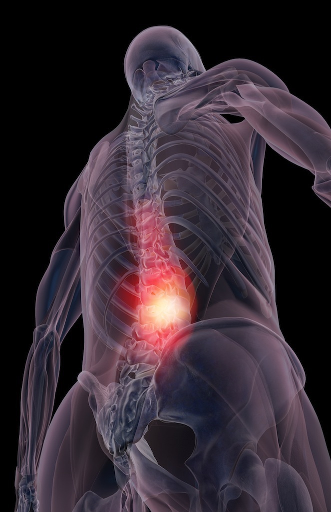Lower back pain can be debilitating but it doesn't need to be. Find out how we can help.