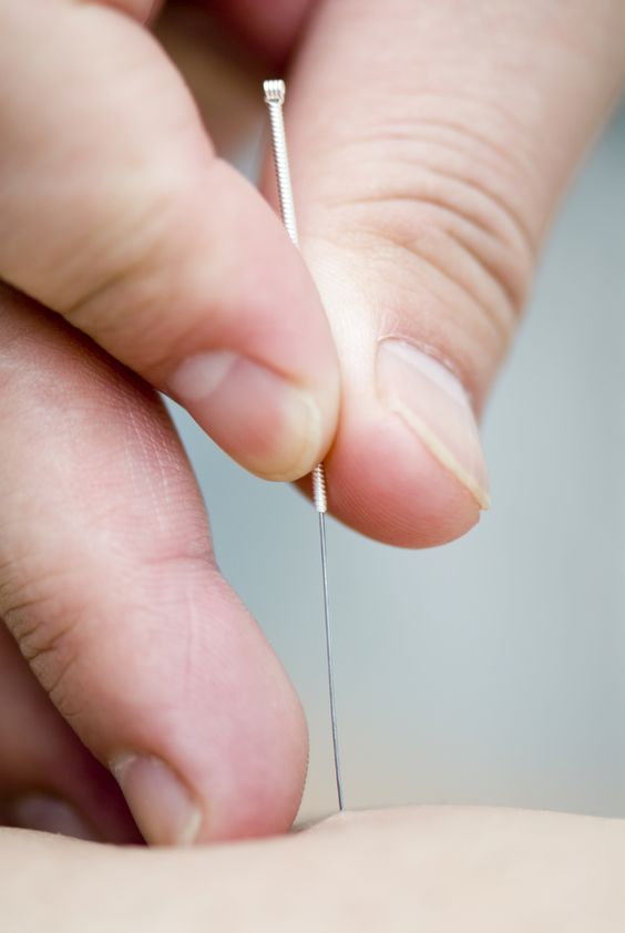 acupuncture painless needle insertion